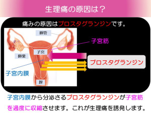 生理痛の原因は？